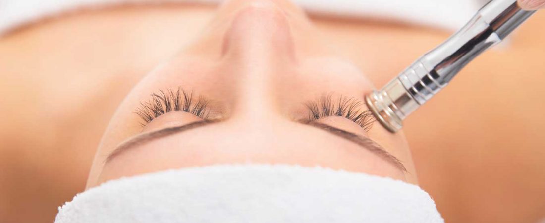 What is Microdermabrasion?