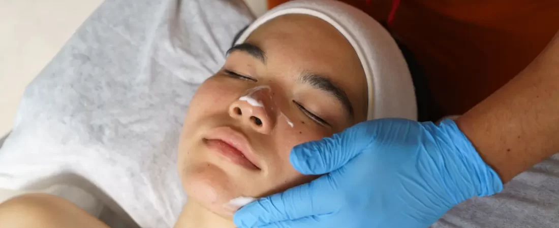 Teen Facials: Essential Acne Care with Organic Solutions